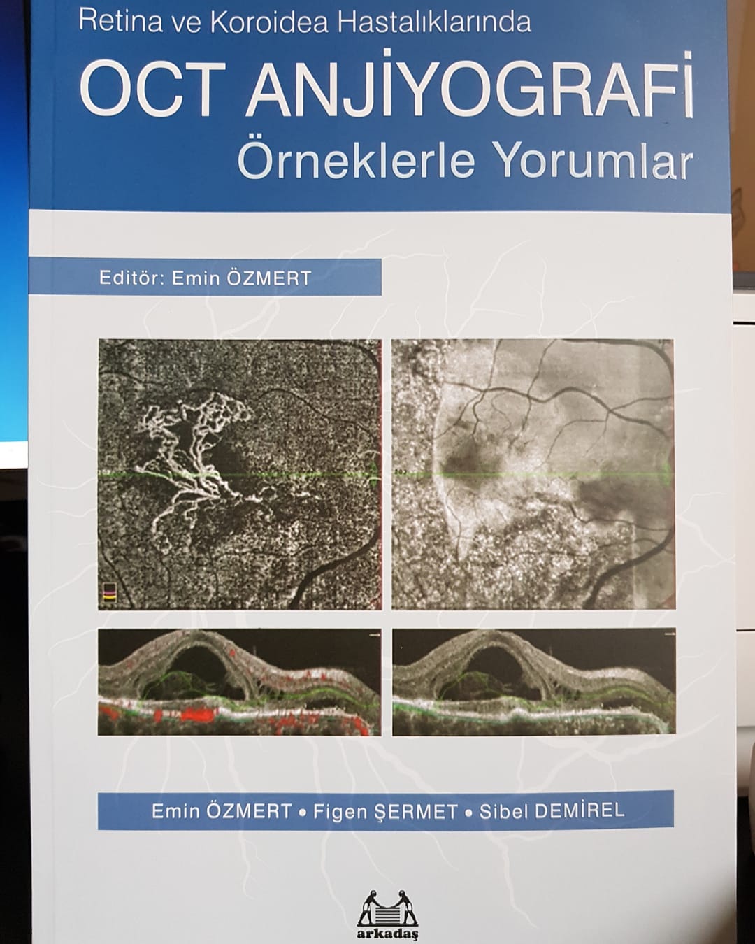 Instagram gönderi görseli