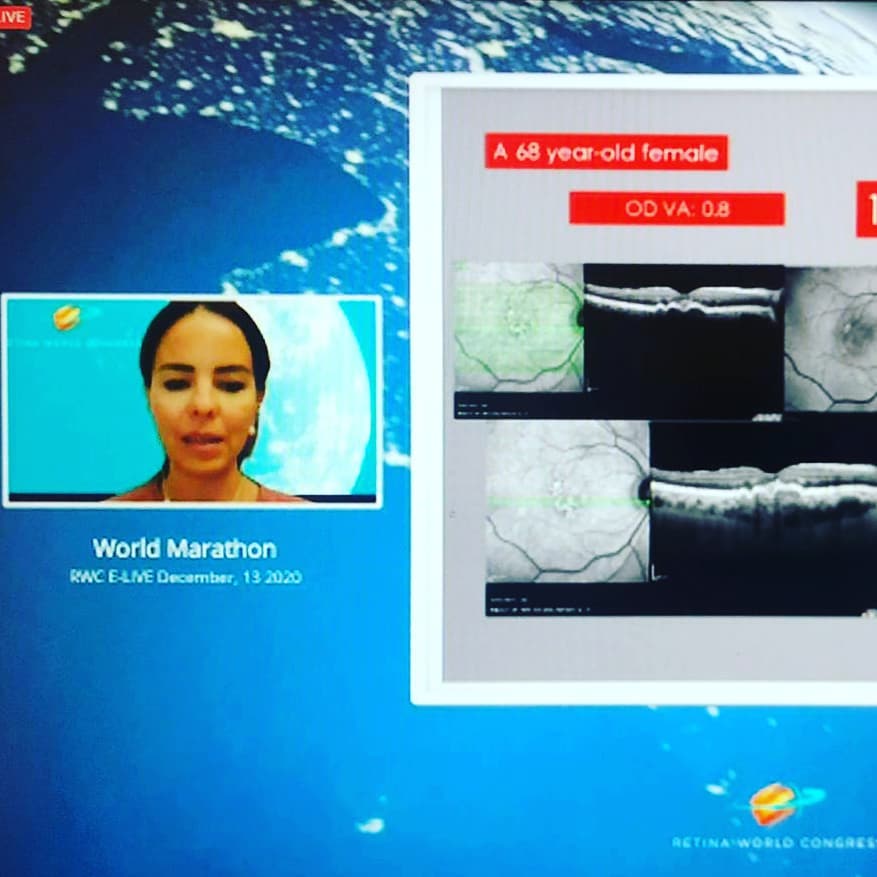 Instagram gönderi görseli
